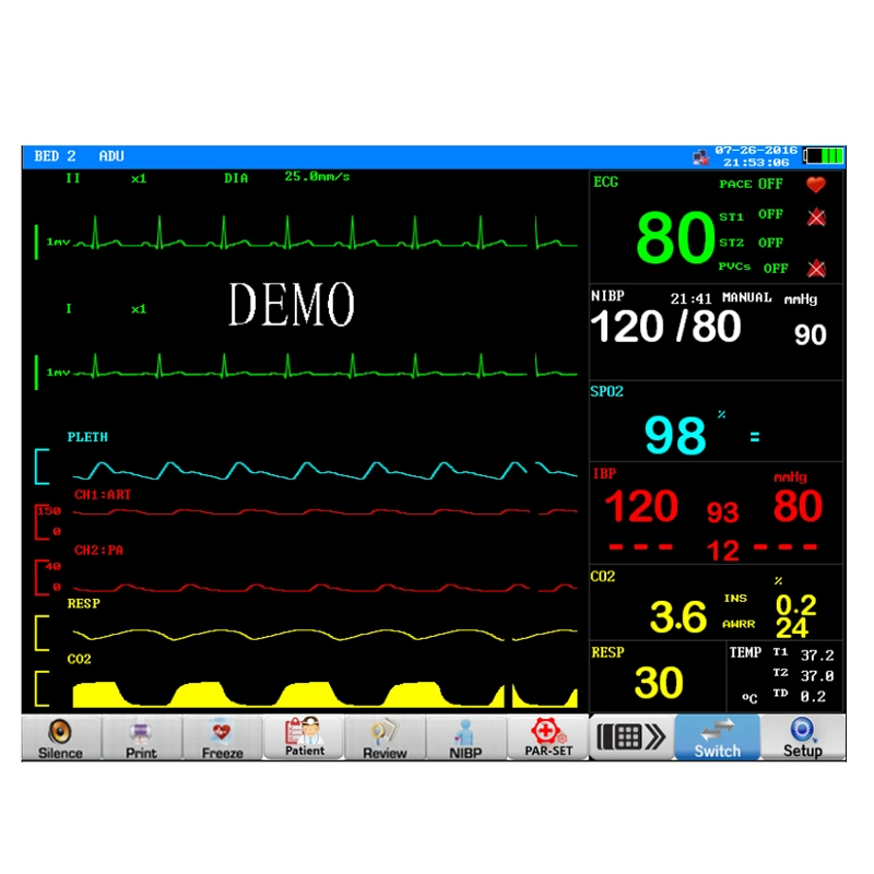 Medical Equipment 15inch Big Screen Multi Parameter Patient Monitor for ICU Used