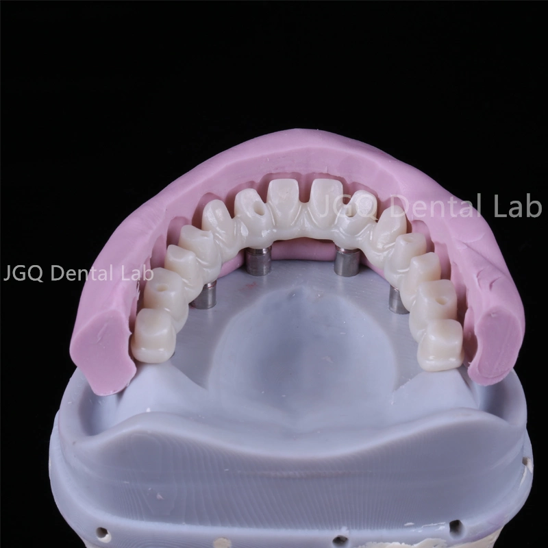 Implant dentaire Personnaliser Super structure All-On-6 Full Contour Zirconia Dental Pont d'implant