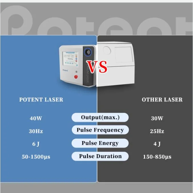 Potent High Pulse Energy Portable Holmium Laser Dusting Lithotripsy Urology for Stone Surgery