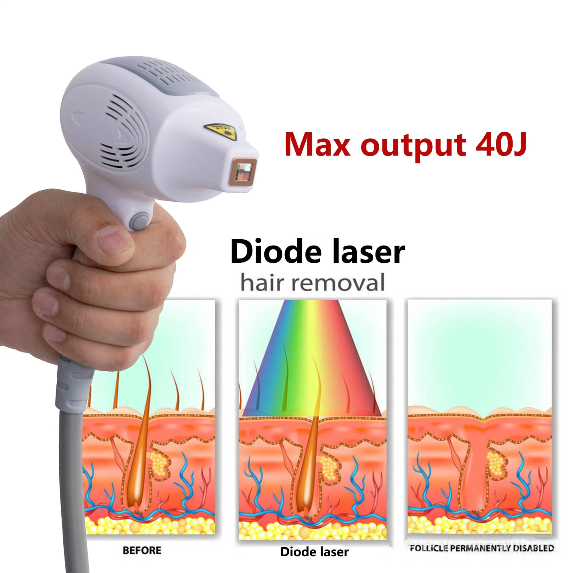 808nm Diode Laser Light Hair Removal Home Use