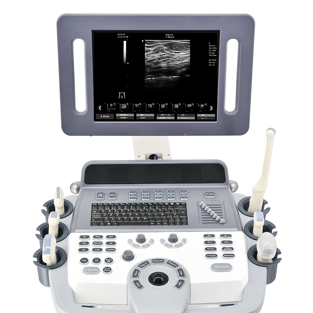 Professional Medical Equipments 3D/4D Trolley Color Doppler Trolley Ultrasound Price