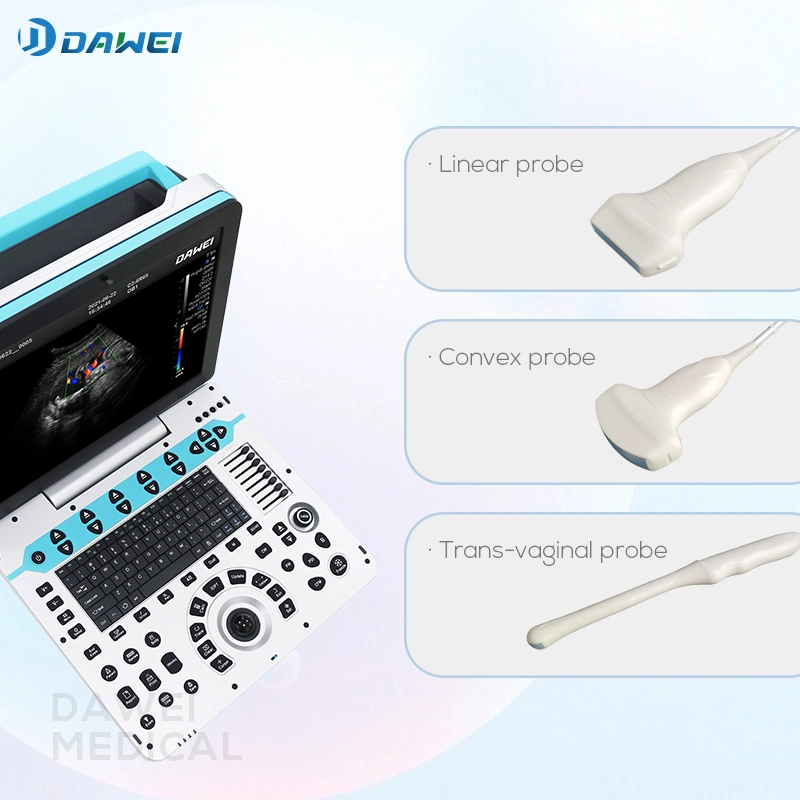 Hot Sales Ultrasound Scanner Equipment for Clinic with CE&ISO