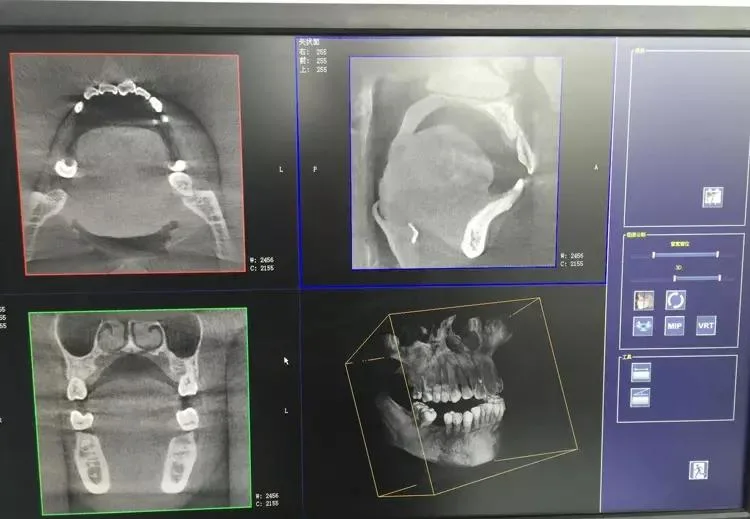 Machine de radiographie dentaire panoramique Cbct