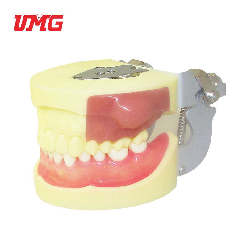 Hochwertige Zähne Anatomisches Modell Kunststoff Dental Modell Pus Entfernen Modell