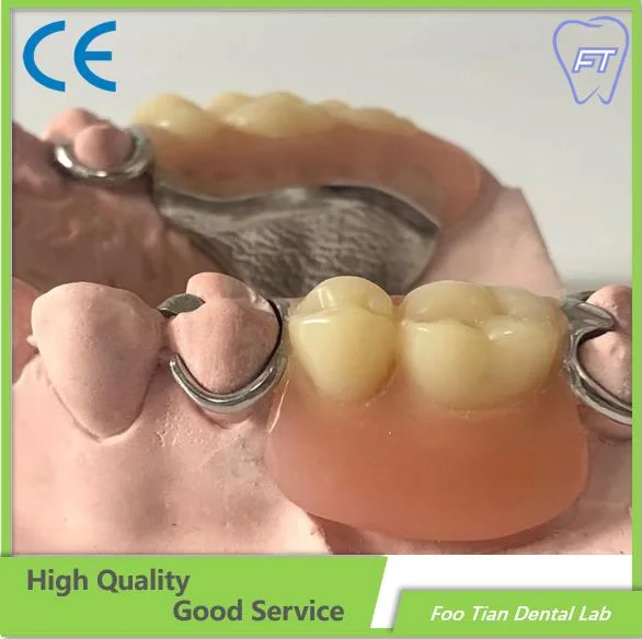 Removable Denture Dental Implant Good Product