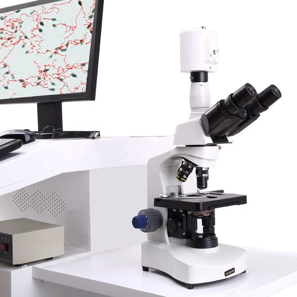 Un buen rendimiento carro barato sistema de análisis de la calidad del esperma/ Analizador de espermatozoides/Análisis de Semen Asistida por Computador