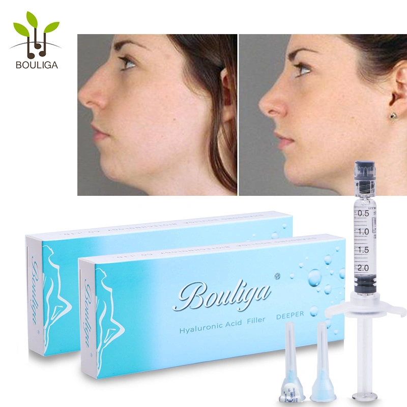 OEM Good Quality Hyaluronic Acid Dermal Filler for Face, Body Beauty