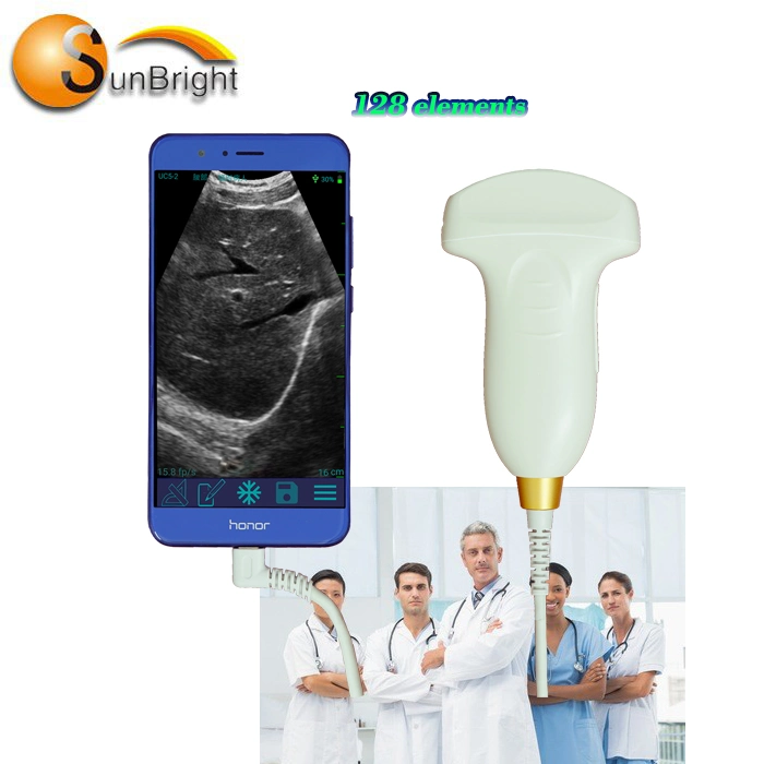 Portable USB Probe Mini Ultrasound Device Medical Hand Held Ultrasound Convex Probe