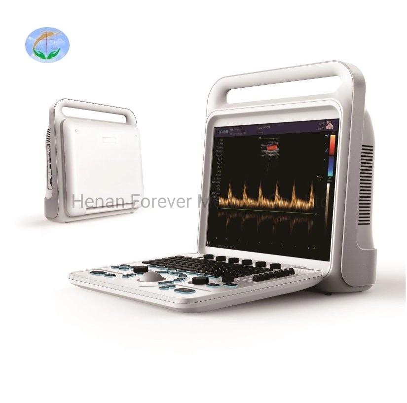 High End Laptop Color Doppler Ultrasound Diagnostic System with Low Price