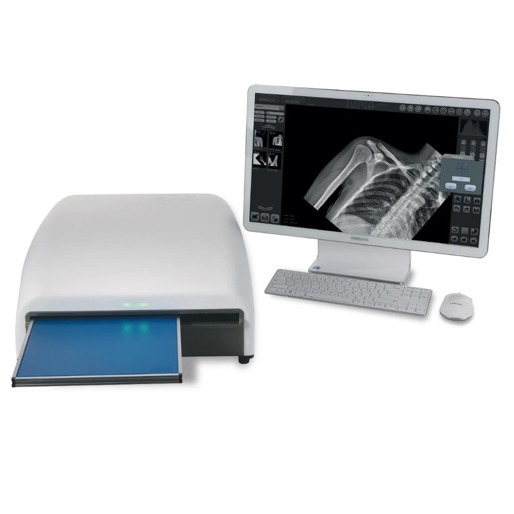 Cr System Computed Radiography Hospital Equipment