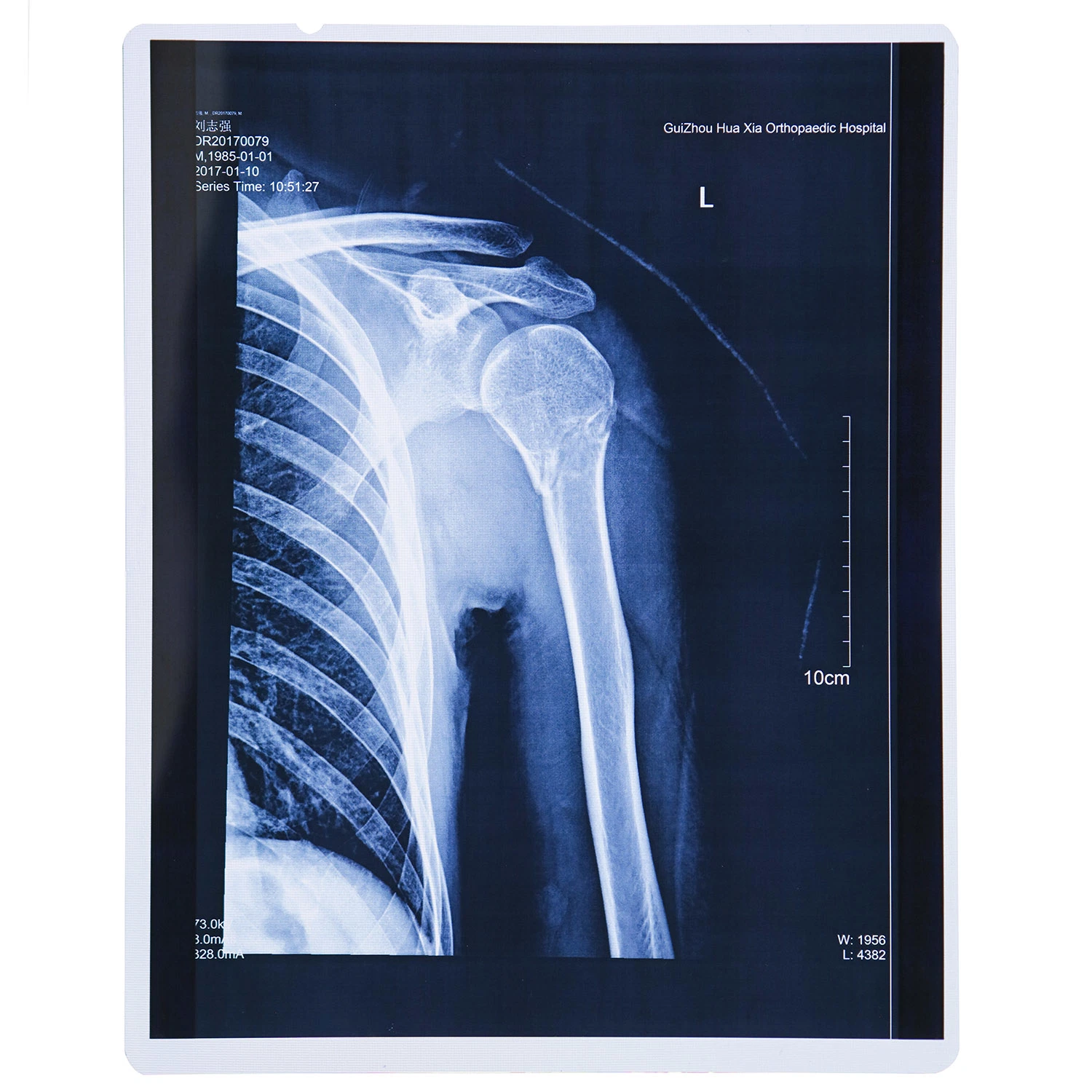 Medical Film Xray Image Printing Use Blue Xray Film Pet Medical Film