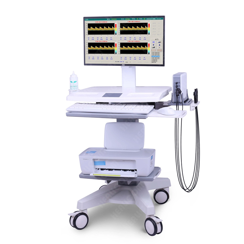 Diagnóstico de enfermedades cerebrales portátil Doppler Color transcraneal equipo