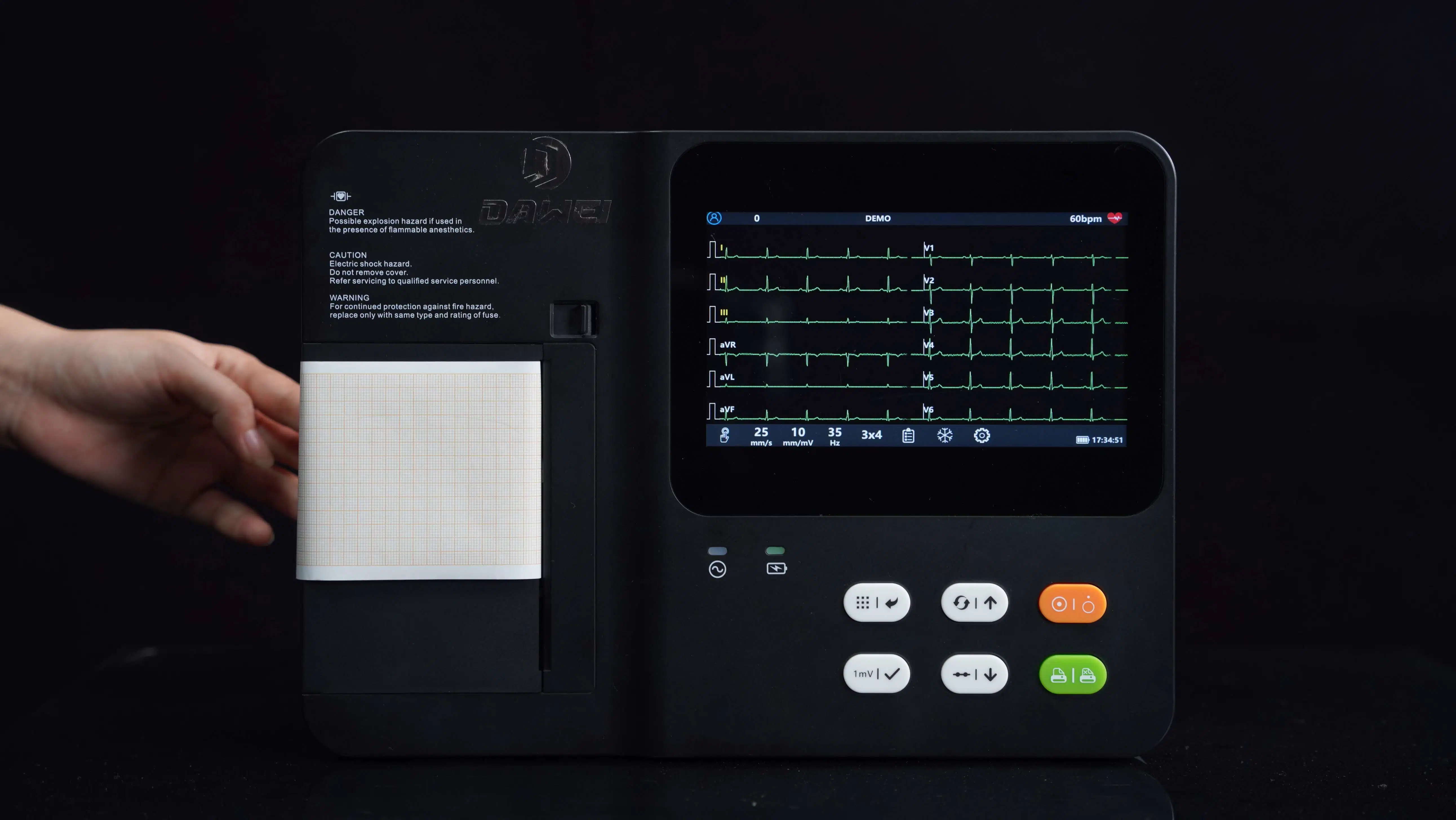 3 canales de alta calidad máquina de ECG EKG Monitor cardíaco de papel