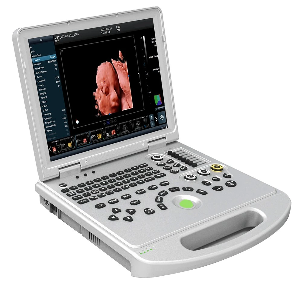 15 Inch LED Medical Display Able to Reverse It Above 160 Degree Portable Ultrasound Machine