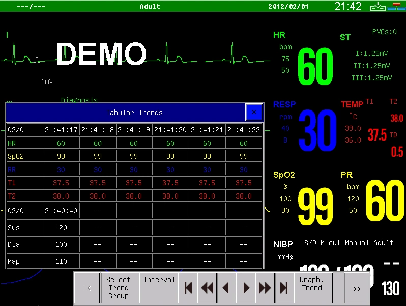 Sinnor Snp9000n de varios equipos de diagnóstico médico con la presión arterial+ la frecuencia cardíaca ECG +