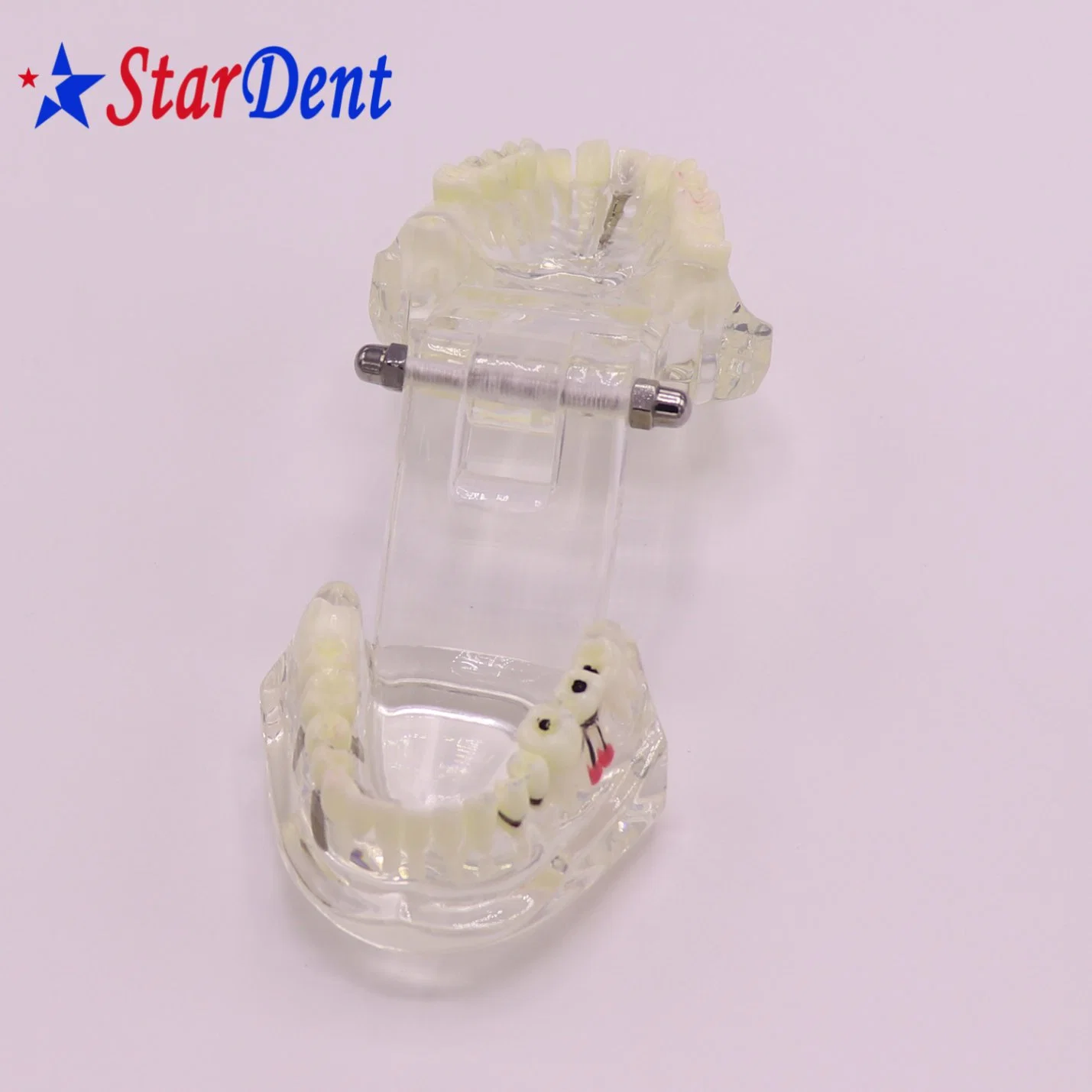 Transparent Adult Pathology Dental Model, Dental Teaching Model Teeth Model