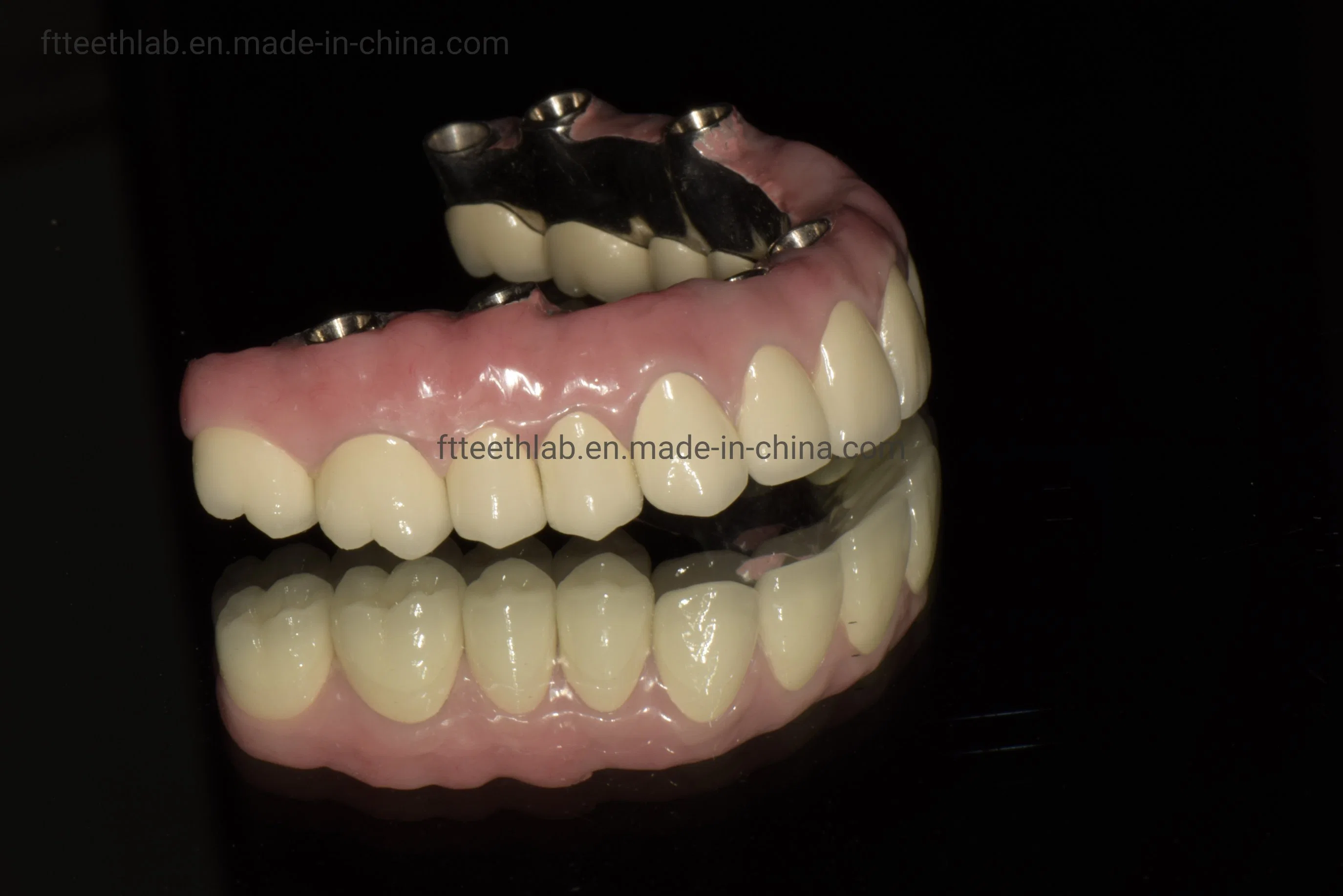 El arco completo de instrumentos dentales de cerámica el material del puente de implantes dentales Blanqueamiento Dental Laboratorio dental de China