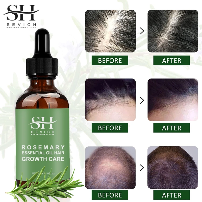 Hair Care Loss Nourishing Scalp Rosemary Mint Hair Growth Oil