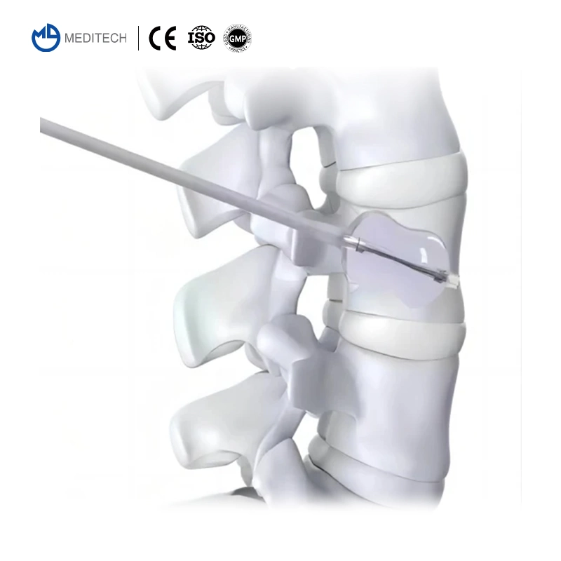 High quality/High cost performance  Percutaneous Access Device Thoracic Layer by Layer Puncture Pvp Guide Needle Vertebral Perforator Kit