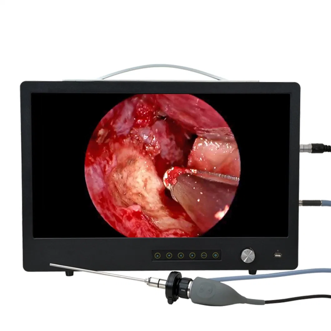 Медицинские Портативная HD видео портативные медицинские эндоскопа камера Full 1080P