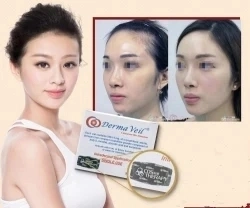 2023 Heiß Verkaufender Dermaveil Poly Milchsäure Plla Profhilo Ellanse Reshape Gesamten Gesicht Dermal Filler Stimulieren Colleagen Filler Injection Aesthefill Etrebelle