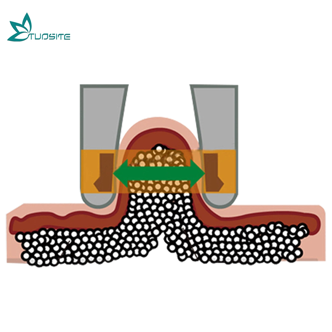 5 en 1 sistema de cavitación por vacío Terapia RF Masaje corporal Máquina de limming corporal