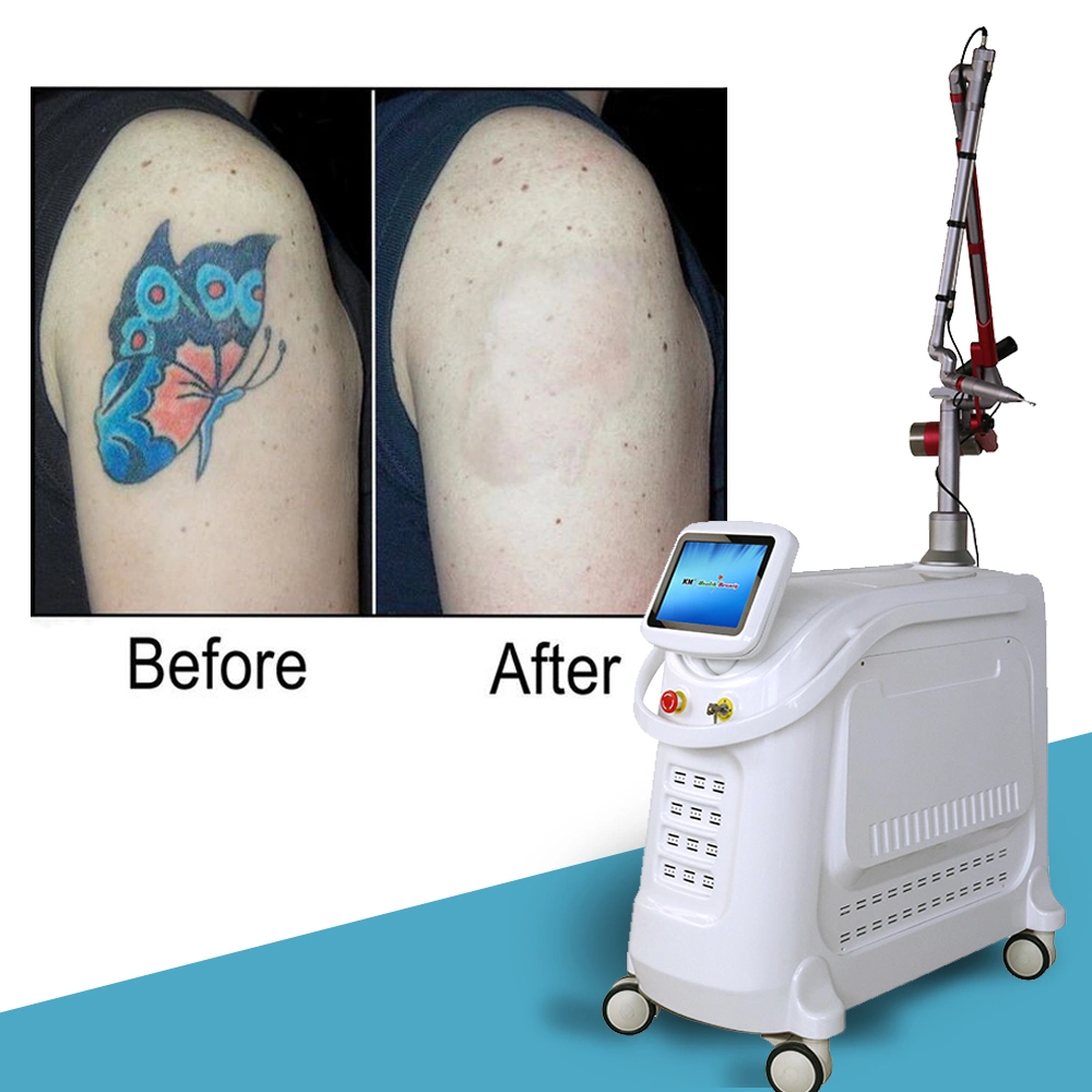 Q Switched ND YAG Laser Tattoo Removal / Picosecond Laser Machine with Korea Laser Arm