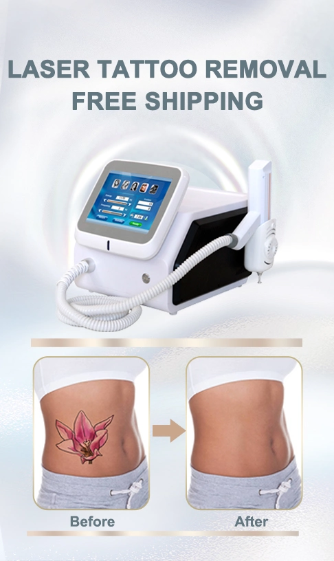 532nm 1064nm remoção da tatuagem profissional de beleza ND YAG Laser Médico