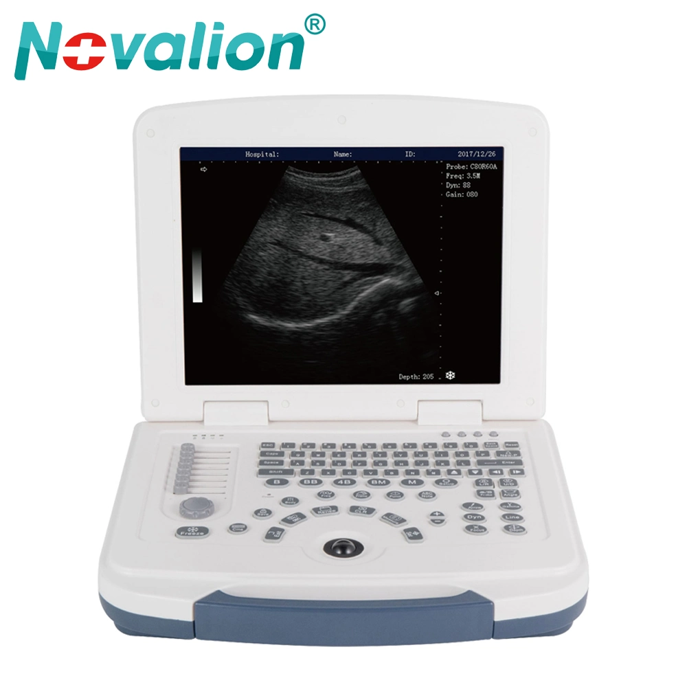 Precio mayorista instrumento médico ultrasónico portátil abdomen Blanco y Negro Sistema de ultrasonido