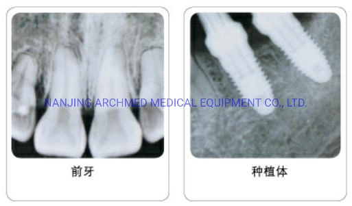 L'équipement médical Poratable haute fréquence numérique de l'équipement de radiographie dentaire