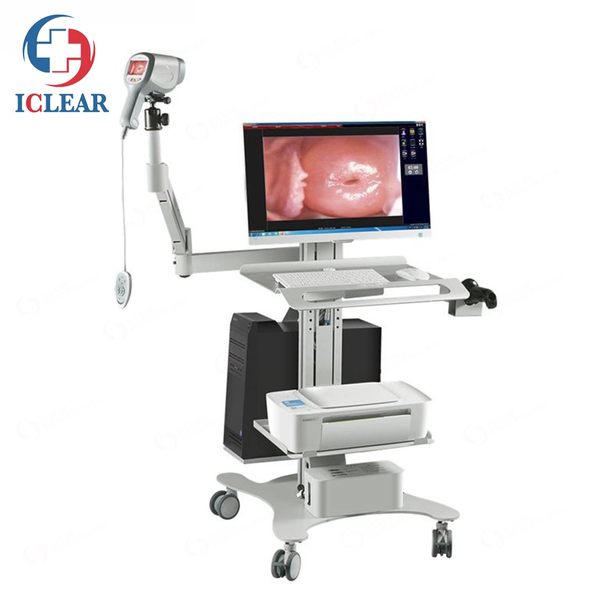 Sony CCD 2.1 Million Medical Digital HD Video Gynecology Colposcopy Equipment