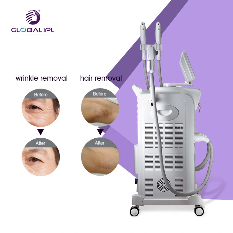 3 in 1 Multifunction Elight IPL Opt +755nm Picosecond Laser + RF Laser Hair Rremoval/ 360 Magneto Optical System