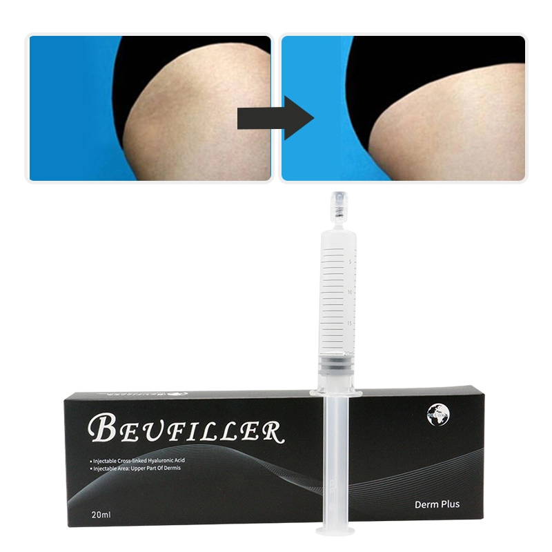 Reasonable Price for China 10ml 20ml CE Injectable Buttocks Breast Enlargement Hyaluronic Acid Dermal Filler Buttock Augmentation Injection