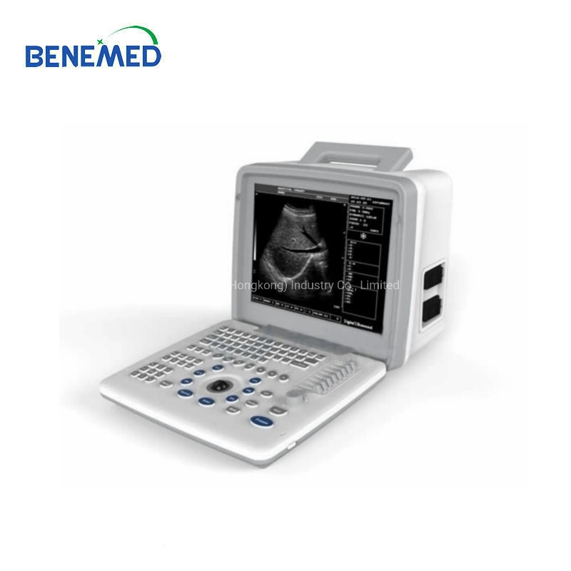 Scanner de ultrassons a P/B portátil com qualidade de imagem nítida