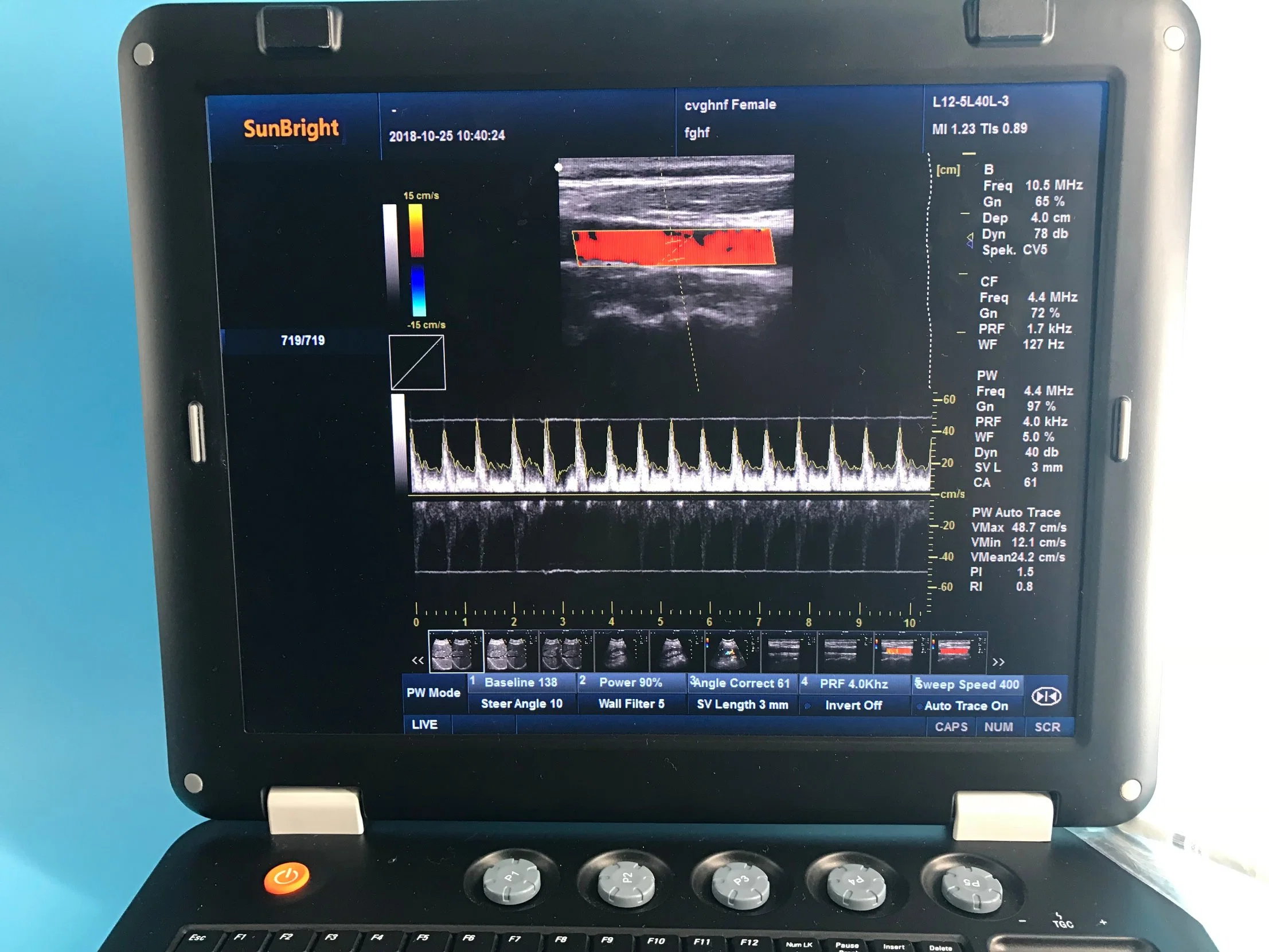 Original Hersteller Color Doppler Diagnostic Apparate Ultraschall Laptop Maschine