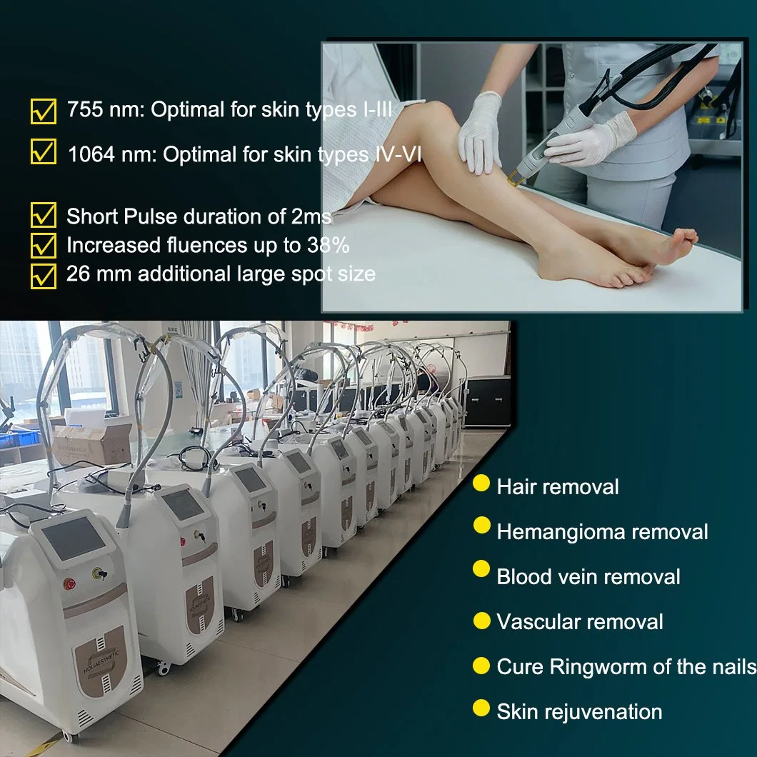 Beijing Long Pulse Alexandrite Laser Hair Removal/Alexandrite Laser 755nm Hair Removal Equipment