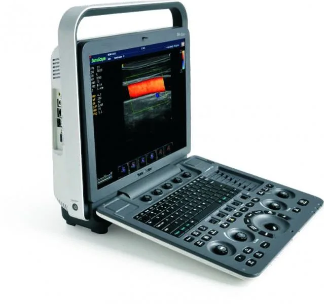 Sonoscape S8expv escáner de ultrasonidos veterinarios