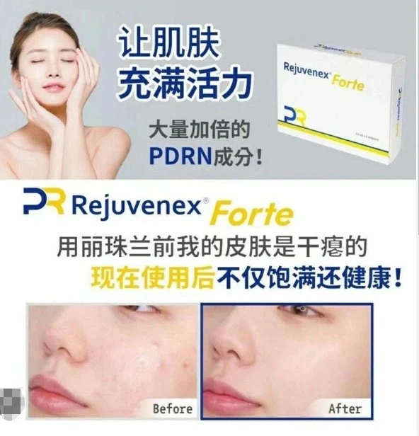 2023 Korea Rejuran Pdrn origen Mesotheraphy Rejuran Pdrn Salmón Rejuvenex Forte piel Rejuvenecimiento bebé cara bebé piel piel Boosters piel Potenciador