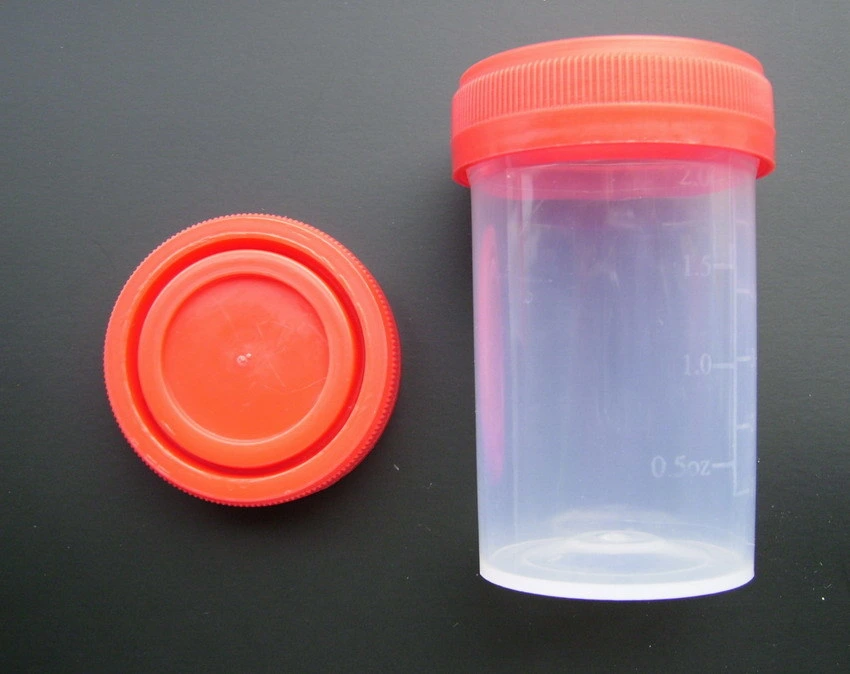 Medical Polymer Materials 60ml Labeled Specimen Container