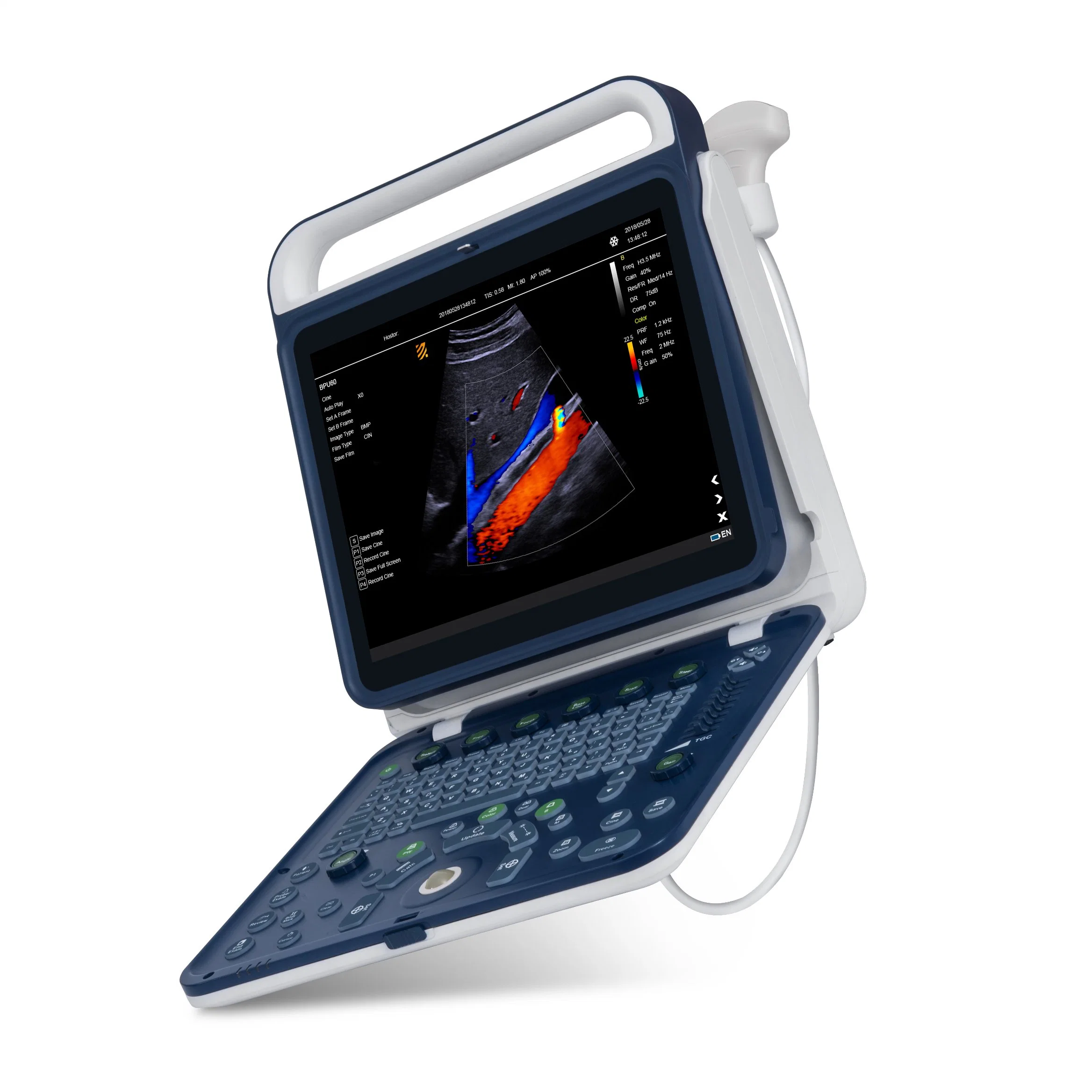 Meu-A027e Mayamed lado transportadas Laptop da máquina de ultra-som portátil Doppler a cores scanner de ultra-som