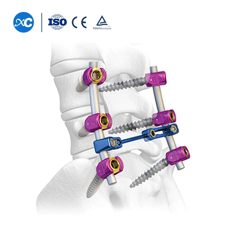 Fábrica Precio Mayorista/Proveedor Titanium implantes e instrumentos ortopédicos