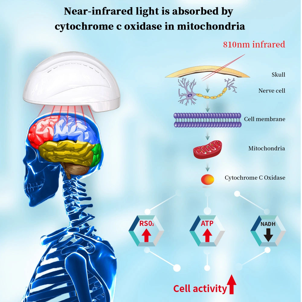 Suyzeko Casco neuroneo Enfermedades cerebrales Helmet de Terapia infrarroja para Alzheimer Parkinson