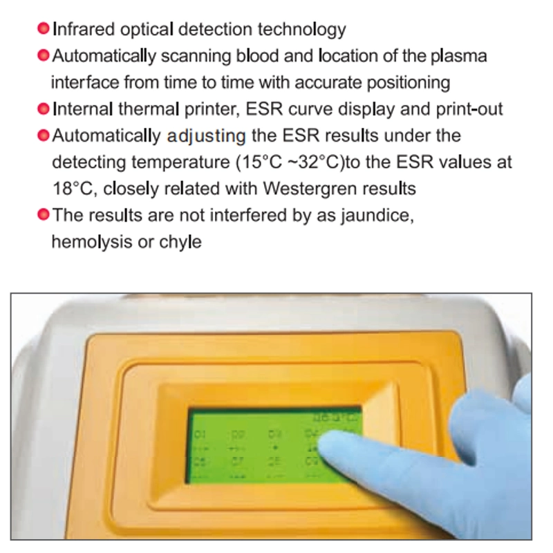 Medidor de ESR máquina de teste de velocidade de hemossedimentação VHS Digital Analyzer