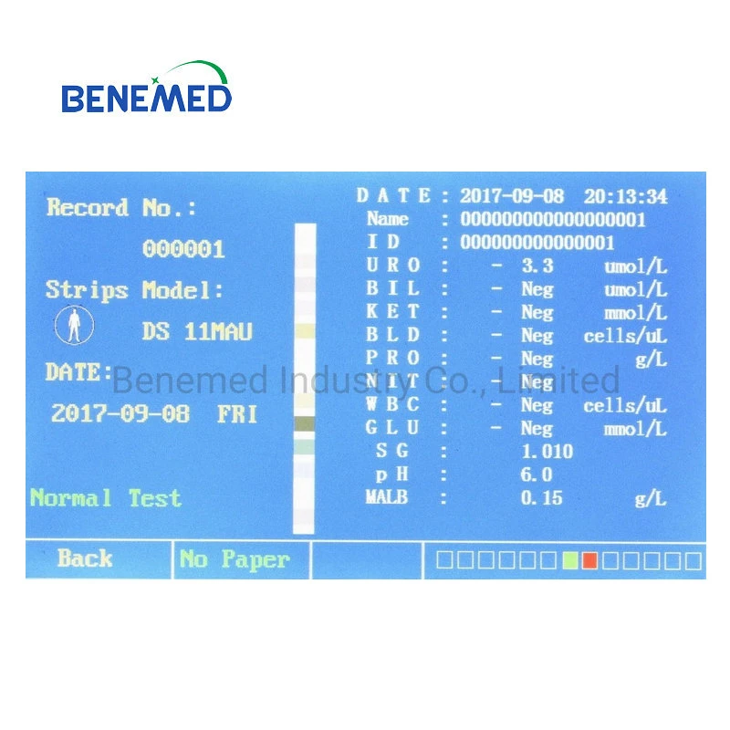 Urinanalyse-Instrument Für Krankenhausgeräte Medizinischer Urinstreifen-Analysator