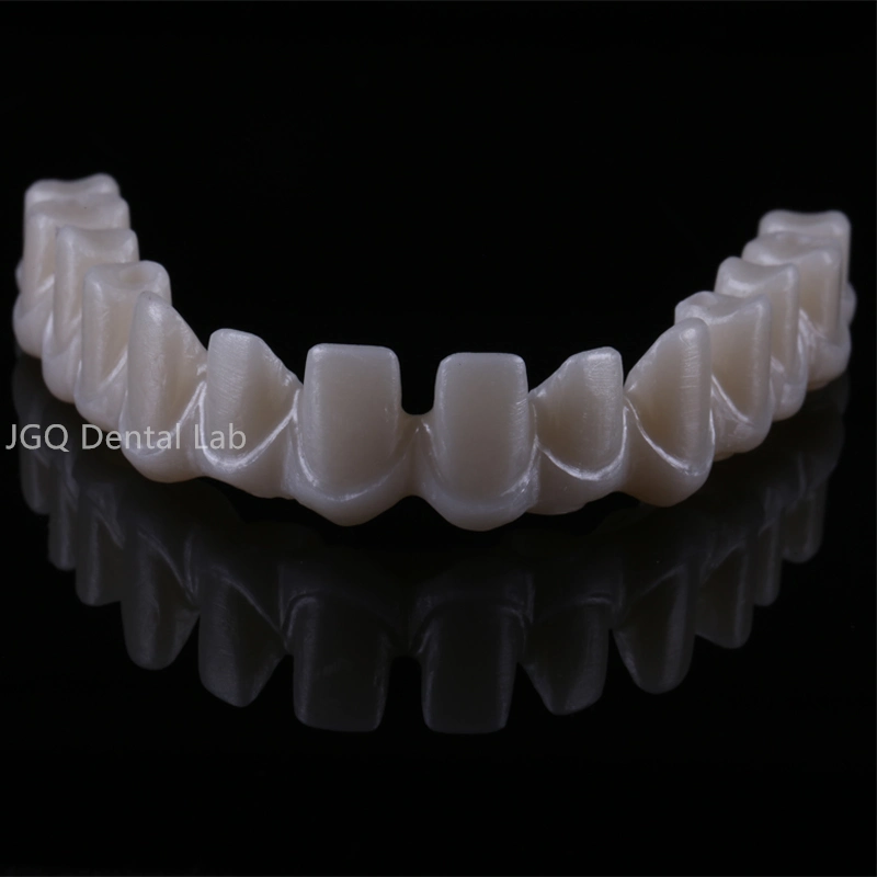 Dental Implant Hybrid Full Jaw Screwed Zirconium Crowns and Bridge From China