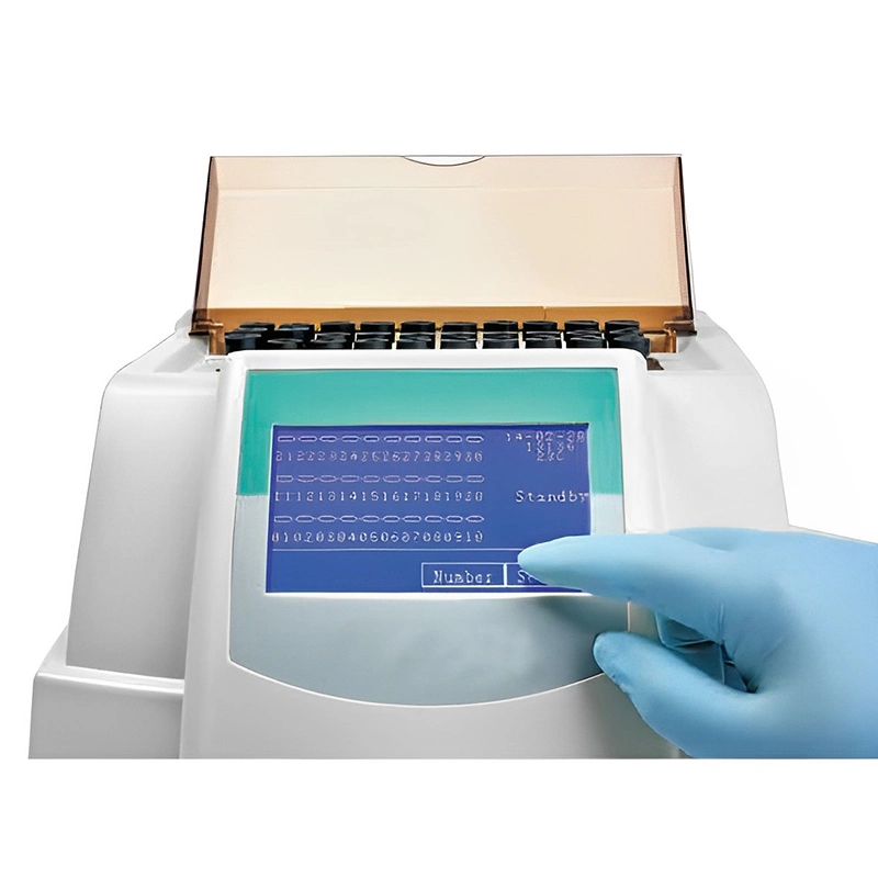 Medidor de ESR máquina de teste de velocidade de hemossedimentação VHS Digital Analyzer