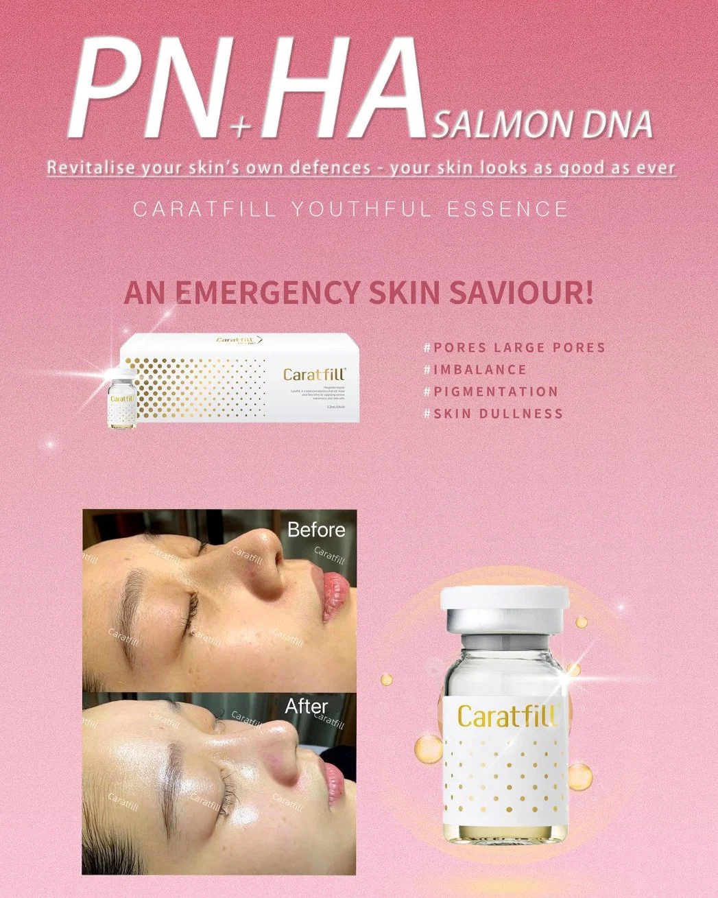 Korean Caratfill Skin Booster Pn + Ha Filler Injection