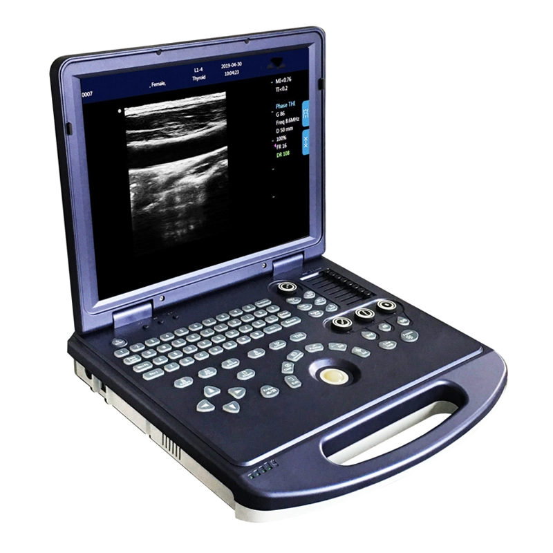 CE, ISO Digital El sistema de diagnóstico médico de escáner de ultrasonido con un bajo precio