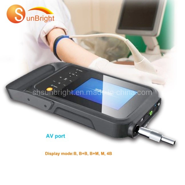 Cardiac Ultrasound Screen Hot Sale Ultrasound with 2 USB Ports