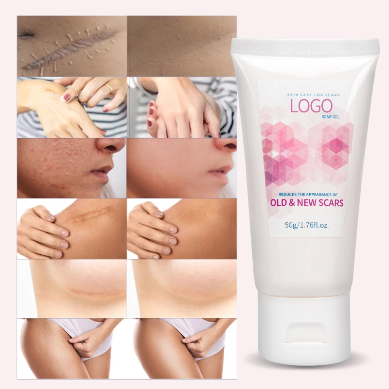 Traitement au silicone de chanvre ancienne et nouvelle crème d'enlèvement de marque de stretch Gel cicatriciel